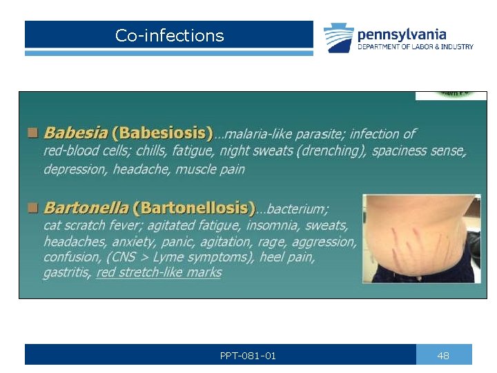 Co-infections PPT-081 -01 48 