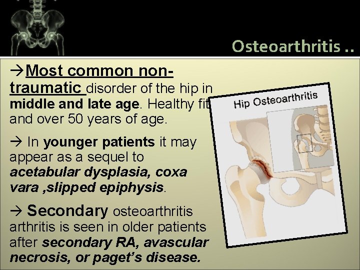 Osteoarthritis. . Most common nontraumatic disorder of the hip in middle and late age.