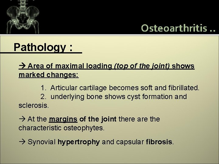 Osteoarthritis. . Pathology : Area of maximal loading (top of the joint) shows marked