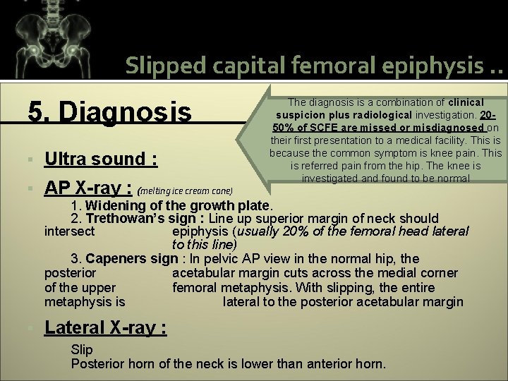 Slipped capital femoral epiphysis. . 5. Diagnosis § Ultra sound : § AP X-ray
