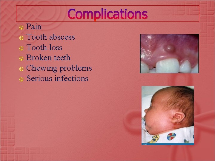 ☺ Pain ☺ Tooth Complications abscess ☺ Tooth loss ☺ Broken teeth ☺ Chewing