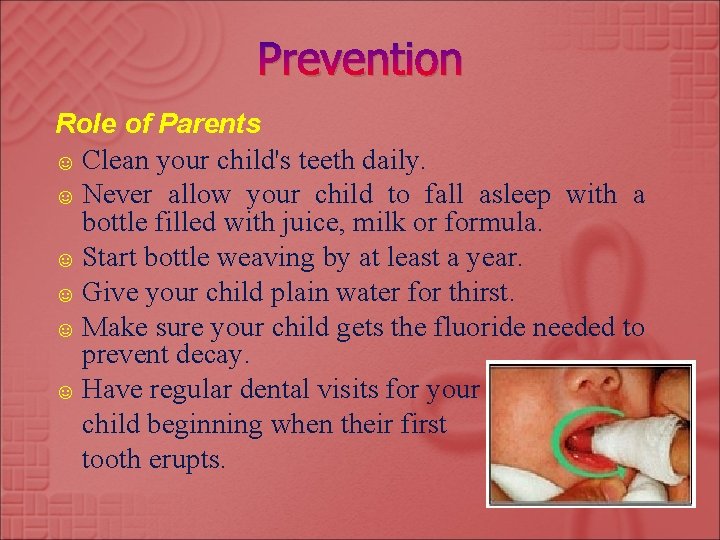 Prevention Role of Parents ☺ Clean your child's teeth daily. ☺ Never allow your