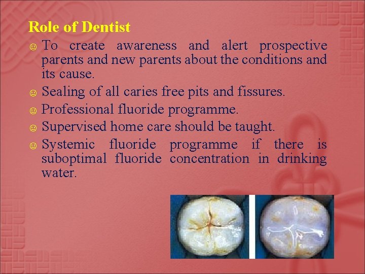 Role of Dentist ☺ To create awareness and alert prospective parents and new parents