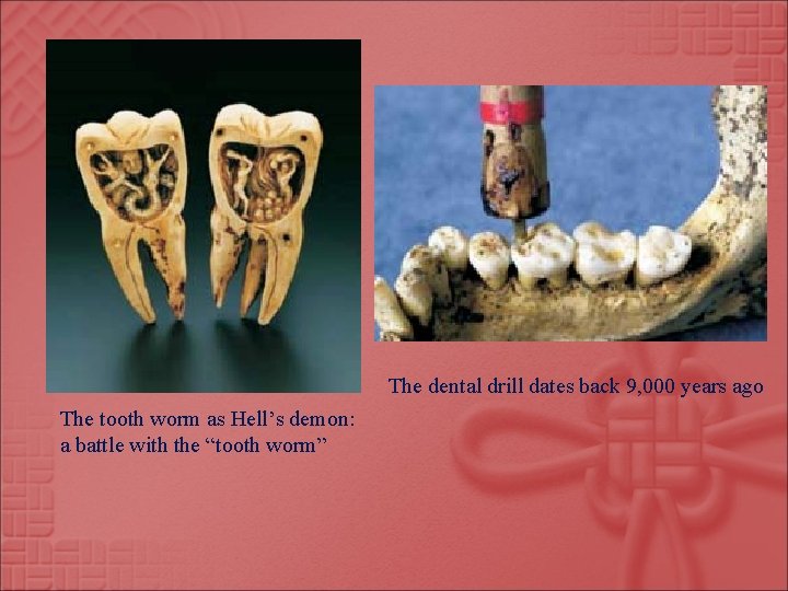 The dental drill dates back 9, 000 years ago The tooth worm as Hell’s