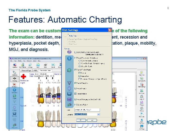 The Florida Probe System Features: Automatic Charting The exam can be customized to record