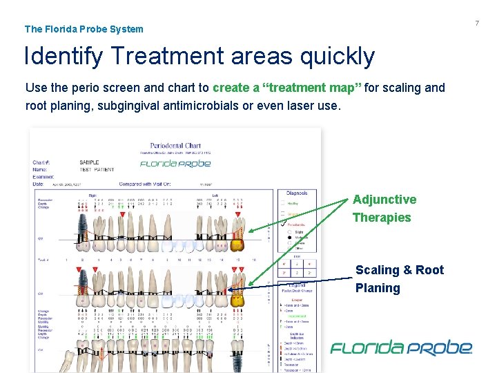 7 The Florida Probe System Identify Treatment areas quickly Use the perio screen and