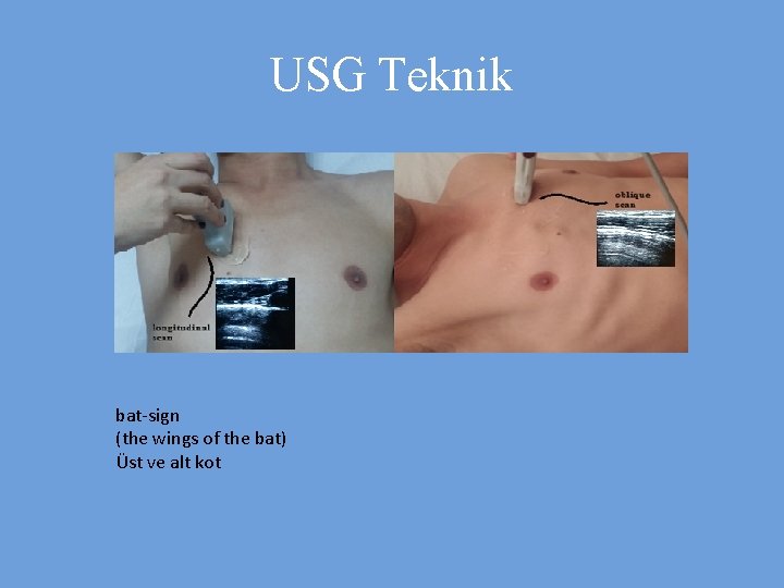 USG Teknik bat-sign (the wings of the bat) Üst ve alt kot 