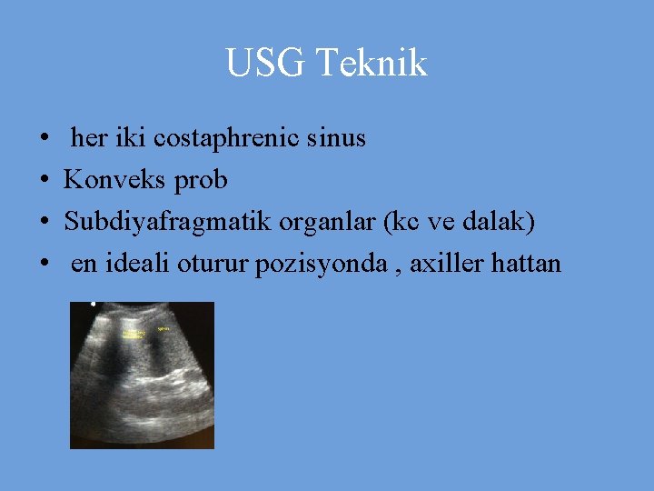 USG Teknik • • her iki costaphrenic sinus Konveks prob Subdiyafragmatik organlar (kc ve