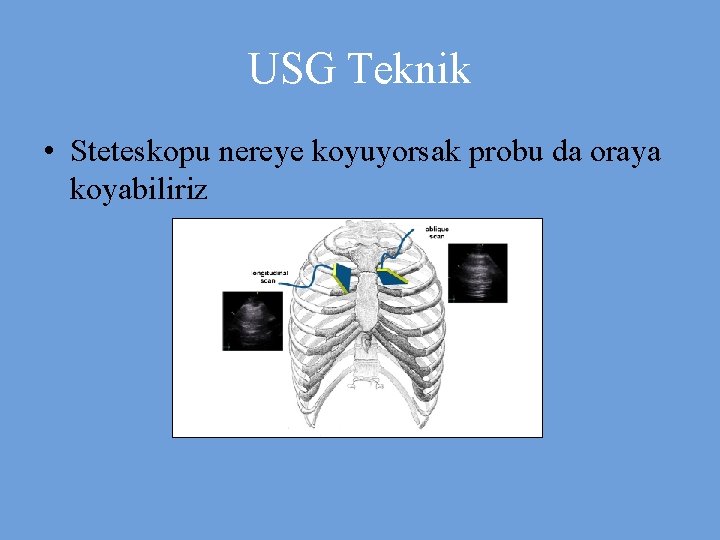 USG Teknik • Steteskopu nereye koyuyorsak probu da oraya koyabiliriz 