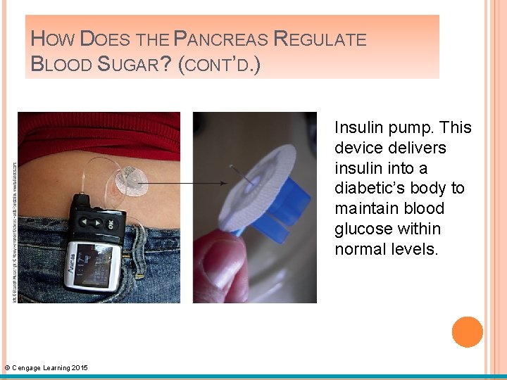 HOW DOES THE PANCREAS REGULATE BLOOD SUGAR? (CONT’D. ) Insulin pump. This device delivers