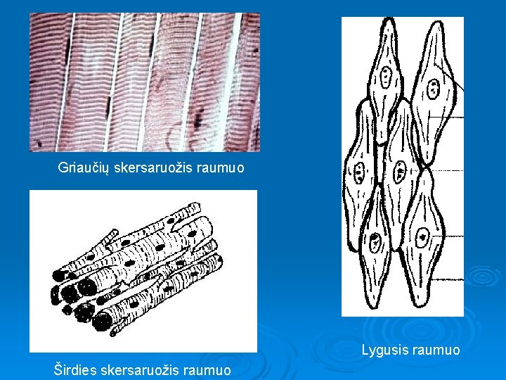 Griaučių skersaruožis raumuo Lygusis raumuo Širdies skersaruožis raumuo 