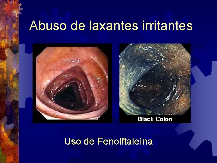 Abuso de laxantes irritantes Uso de Fenolftaleína 