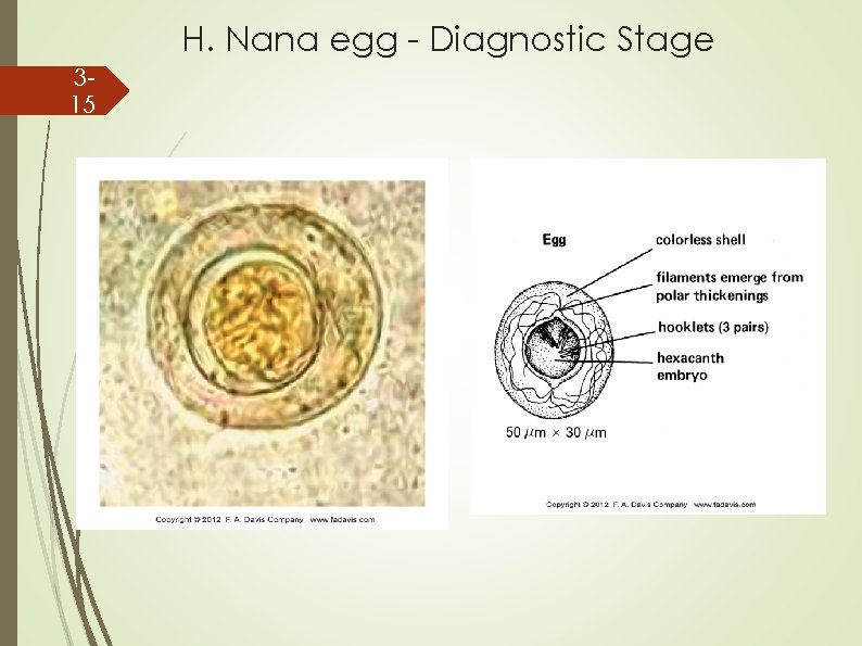 H. Nana egg - Diagnostic Stage 315 