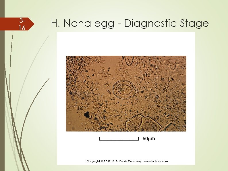 316 H. Nana egg - Diagnostic Stage 