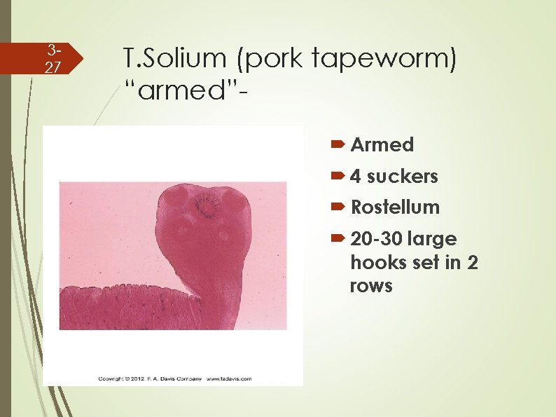 327 T. Solium (pork tapeworm) “armed” Armed 4 suckers Rostellum 20 -30 large hooks