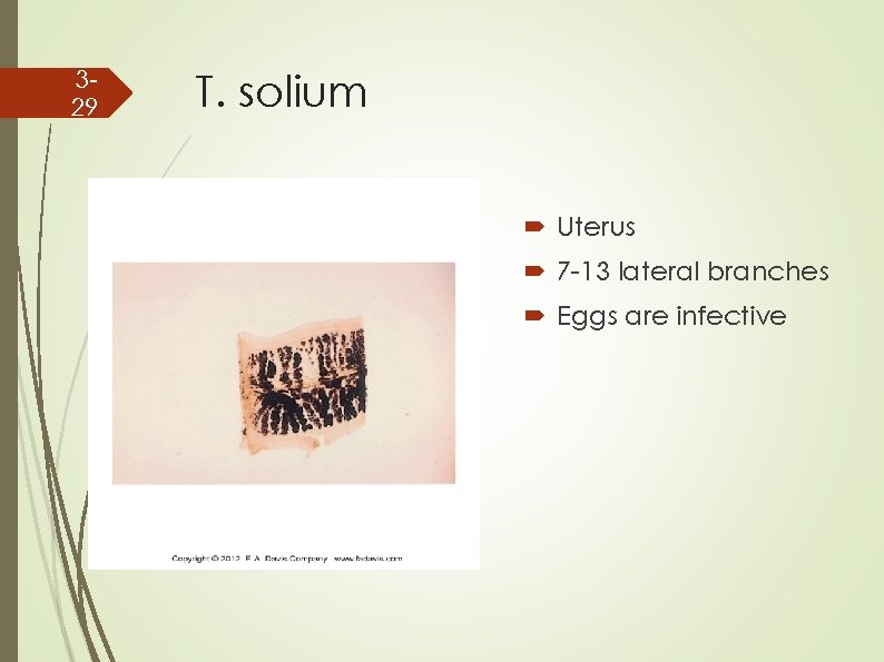 329 T. solium Uterus 7 -13 lateral branches Eggs are infective 