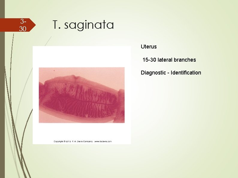 330 T. saginata Uterus 15 -30 lateral branches Diagnostic - Identification 