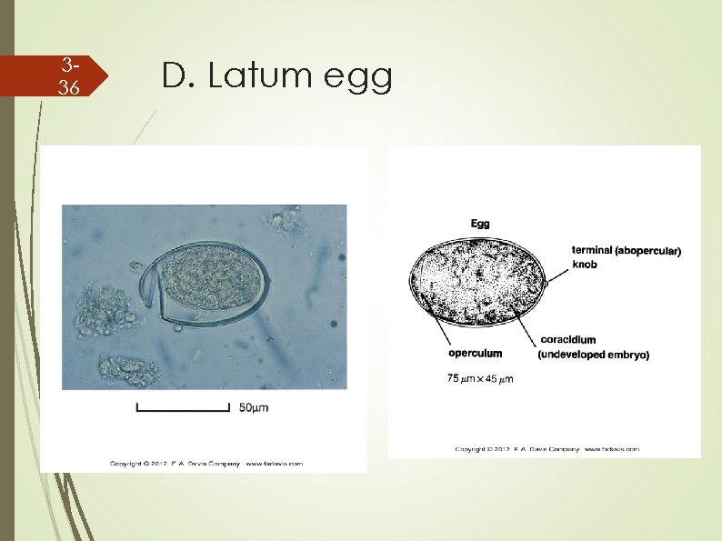 336 D. Latum egg 