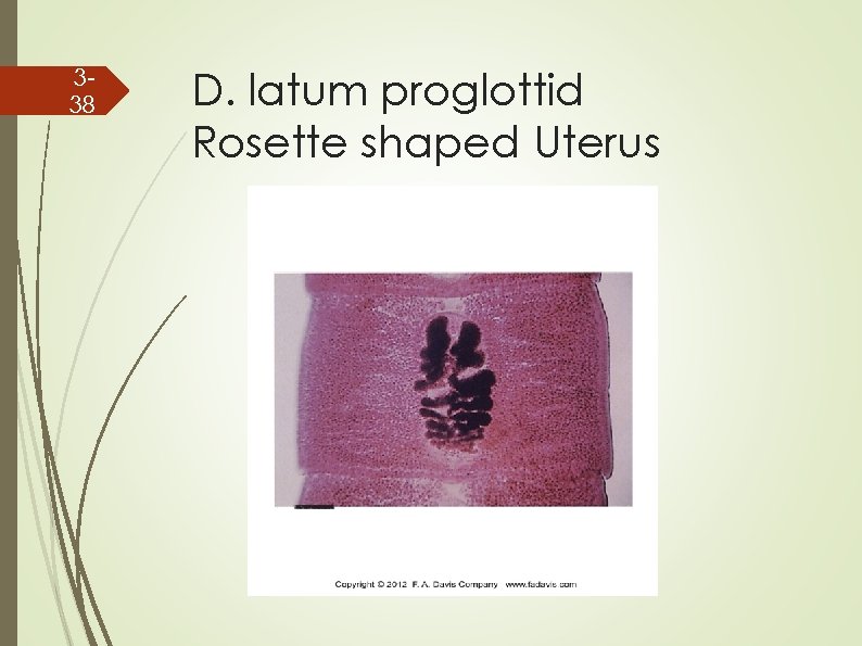 338 D. latum proglottid Rosette shaped Uterus 