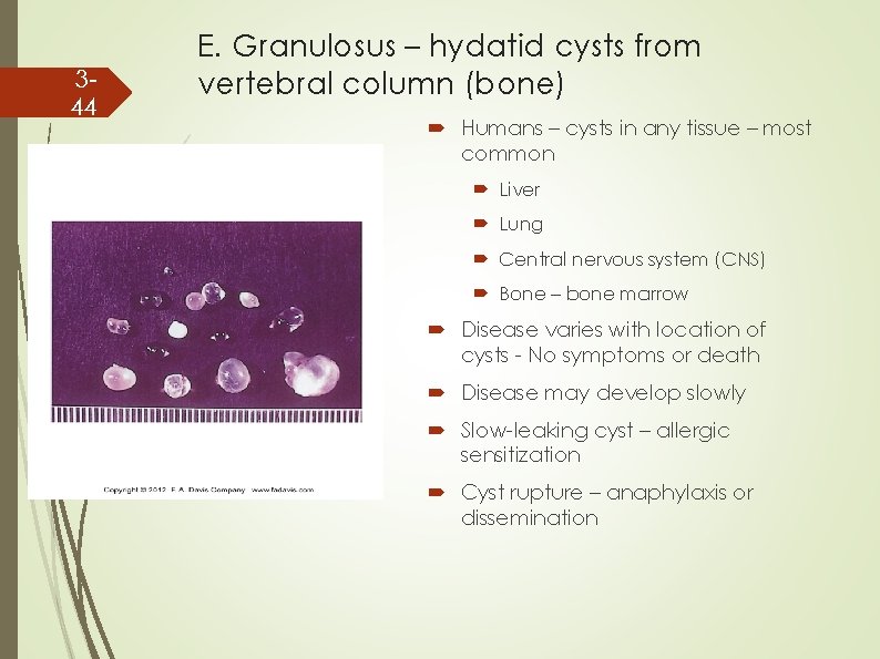 344 E. Granulosus – hydatid cysts from vertebral column (bone) Humans – cysts in