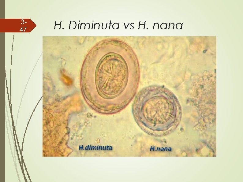 347 H. Diminuta vs H. nana 