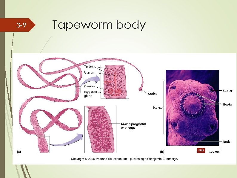 3 -9 Tapeworm body 