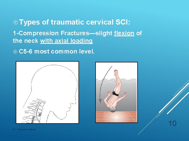  Types of traumatic cervical SCI: 1 -Compression Fractures—slight flexion of the neck with