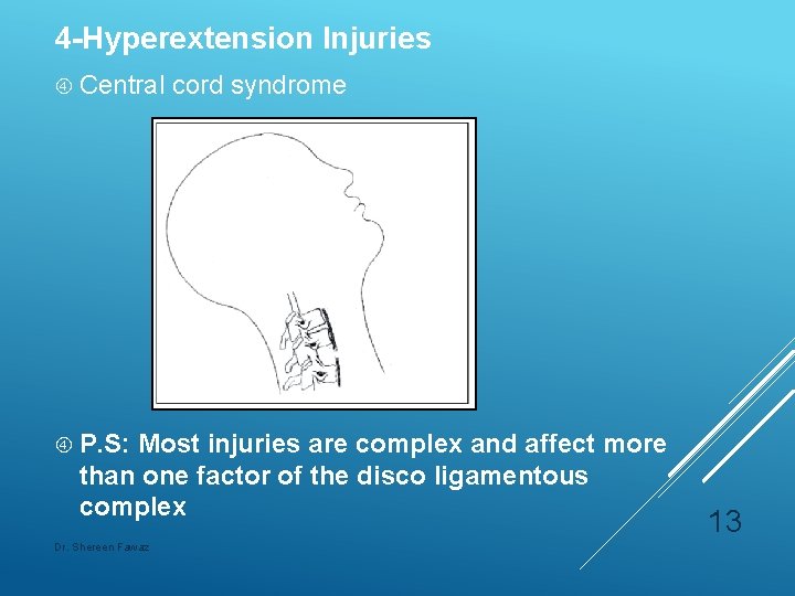 4 -Hyperextension Injuries Central cord syndrome P. S: Most injuries are complex and affect