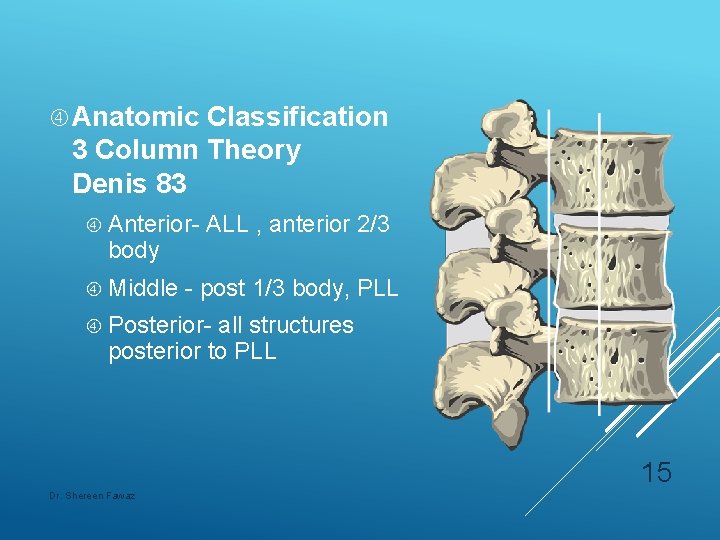  Anatomic Classification 3 Column Theory Denis 83 Anterior- body Middle ALL , anterior