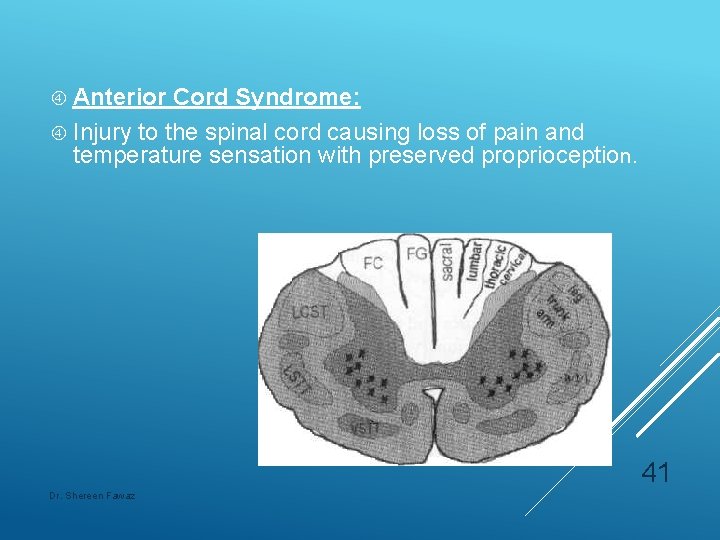  Anterior Cord Syndrome: Injury to the spinal cord causing loss of pain and