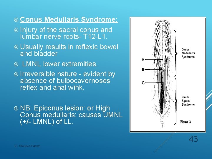  Conus Medullaris Syndrome: Injury of the sacral conus and lumbar nerve roots- T