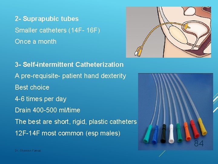 2 - Suprapubic tubes Smaller catheters (14 F- 16 F) Once a month 3