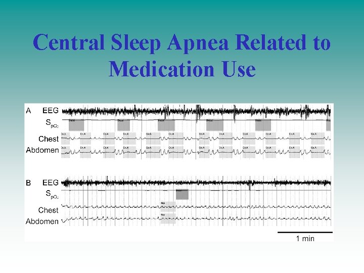 Central Sleep Apnea Related to Medication Use Central Sleep Apnea Related to Medication Use