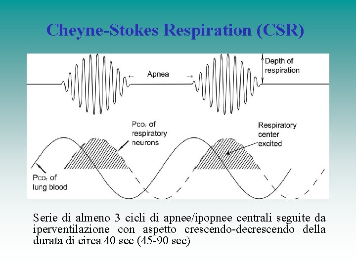 Cheyne-Stokes Respiration (CSR) Serie di almeno 3 cicli di apnee/ipopnee centrali seguite da iperventilazione Cheyne-Stokes Respiration (CSR) Serie di almeno 3 cicli di apnee/ipopnee centrali seguite da iperventilazione
