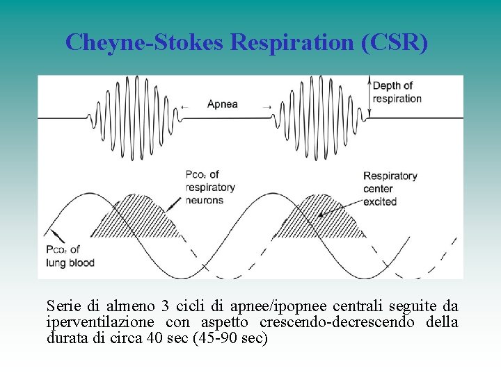 Cheyne-Stokes Respiration (CSR) Serie di almeno 3 cicli di apnee/ipopnee centrali seguite da iperventilazione