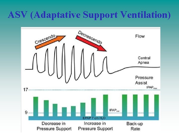 ASV (Adaptative Support Ventilation) ASV (Adaptative Support Ventilation)