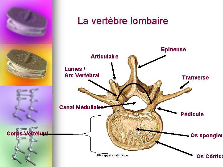 La vertèbre lombaire Epineuse Articulaire Lames / Arc Vertébral Tranverse Canal Médullaire Pédicule Corps La vertèbre lombaire Epineuse Articulaire Lames / Arc Vertébral Tranverse Canal Médullaire Pédicule Corps
