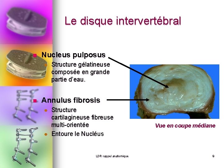 Le disque intervertébral n Nucleus pulposus l n Structure gélatineuse composée en grande partie Le disque intervertébral n Nucleus pulposus l n Structure gélatineuse composée en grande partie
