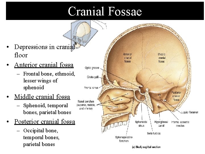 Cranial Fossae • Depressions in cranial floor • Anterior cranial fossa – Frontal bone,