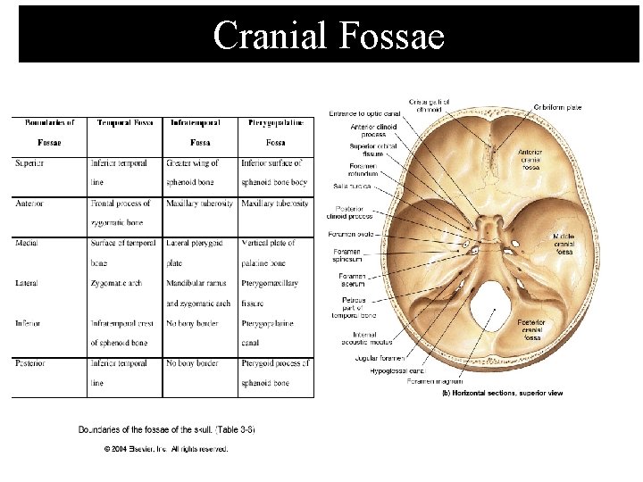 Cranial Fossae 