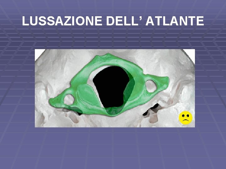 LUSSAZIONE DELL’ ATLANTE 