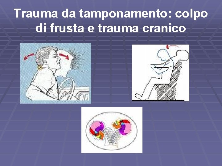 Trauma da tamponamento: colpo di frusta e trauma cranico 