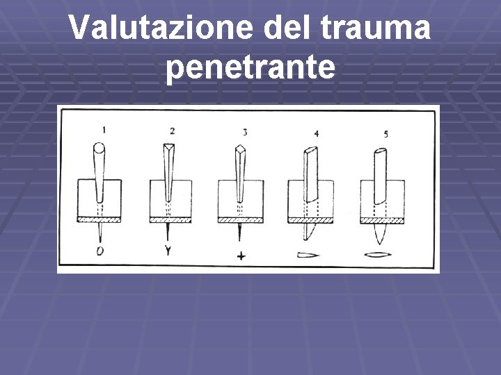 Valutazione del trauma penetrante 
