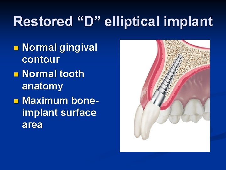Restored “D” elliptical implant Normal gingival contour n Normal tooth anatomy n Maximum boneimplant