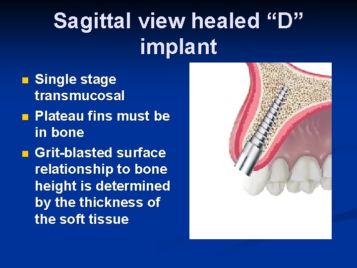 Sagittal view healed “D” implant n n n Single stage transmucosal Plateau fins must