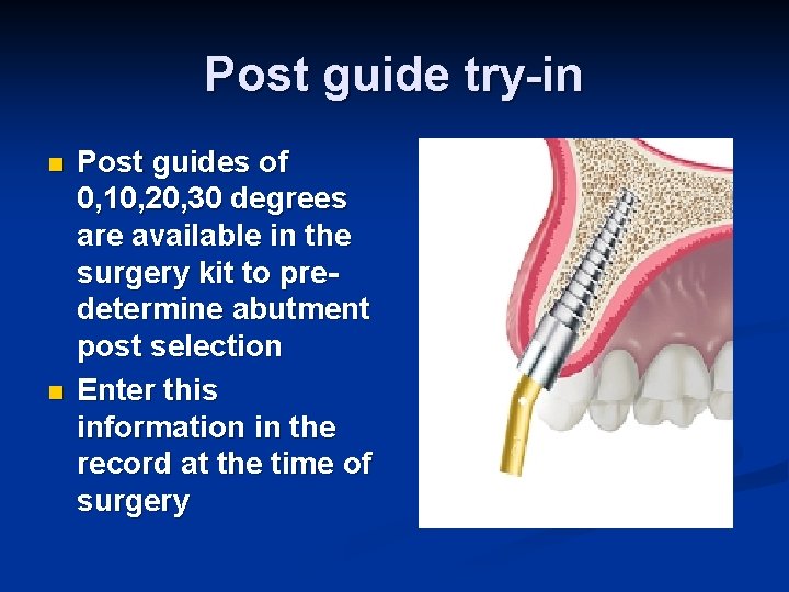 Post guide try-in n n Post guides of 0, 10, 20, 30 degrees are