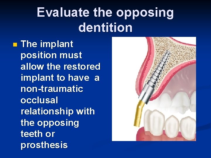 Evaluate the opposing dentition n The implant position must allow the restored implant to