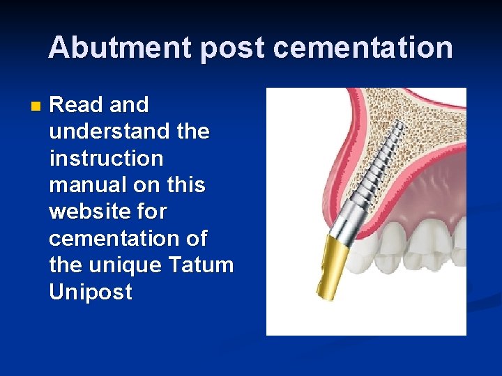 Abutment post cementation n Read and understand the instruction manual on this website for