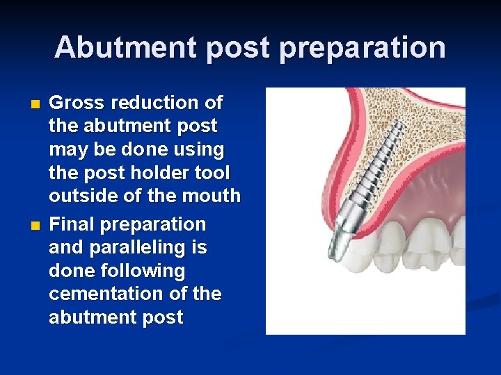 Abutment post preparation n n Gross reduction of the abutment post may be done