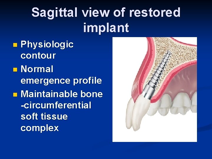 Sagittal view of restored implant Physiologic contour n Normal emergence profile n Maintainable bone